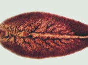 liver fluke